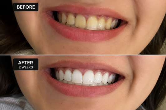 Advanced Teeth Whitening Powder