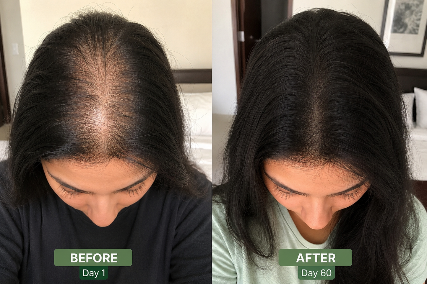 SweetnSmile Organic Hair Growth Oil (120ml)