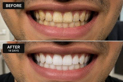 Advanced Teeth Whitening Powder